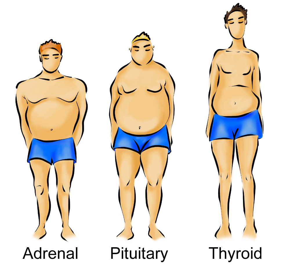 What Is My Body Type The Body Type Diet